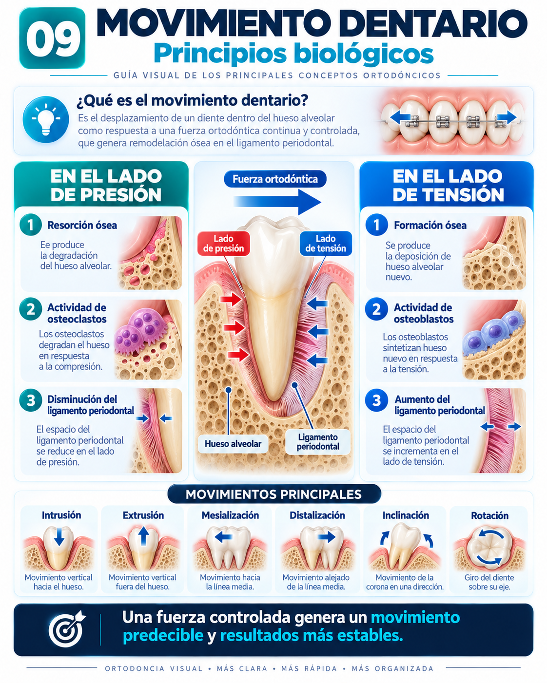 Movimiento Dentario