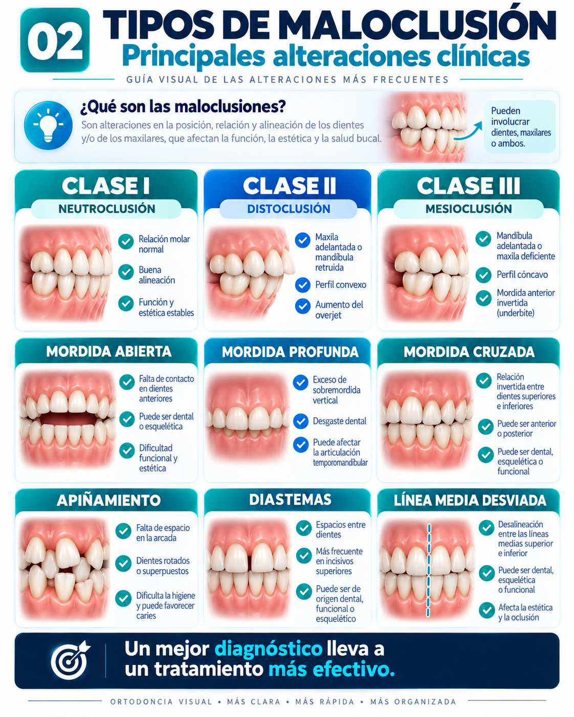 Tipos de Maloclusión