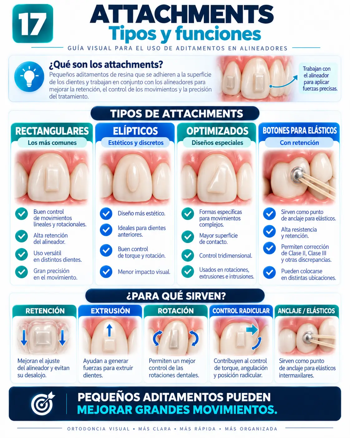 Attachments en Alineadores