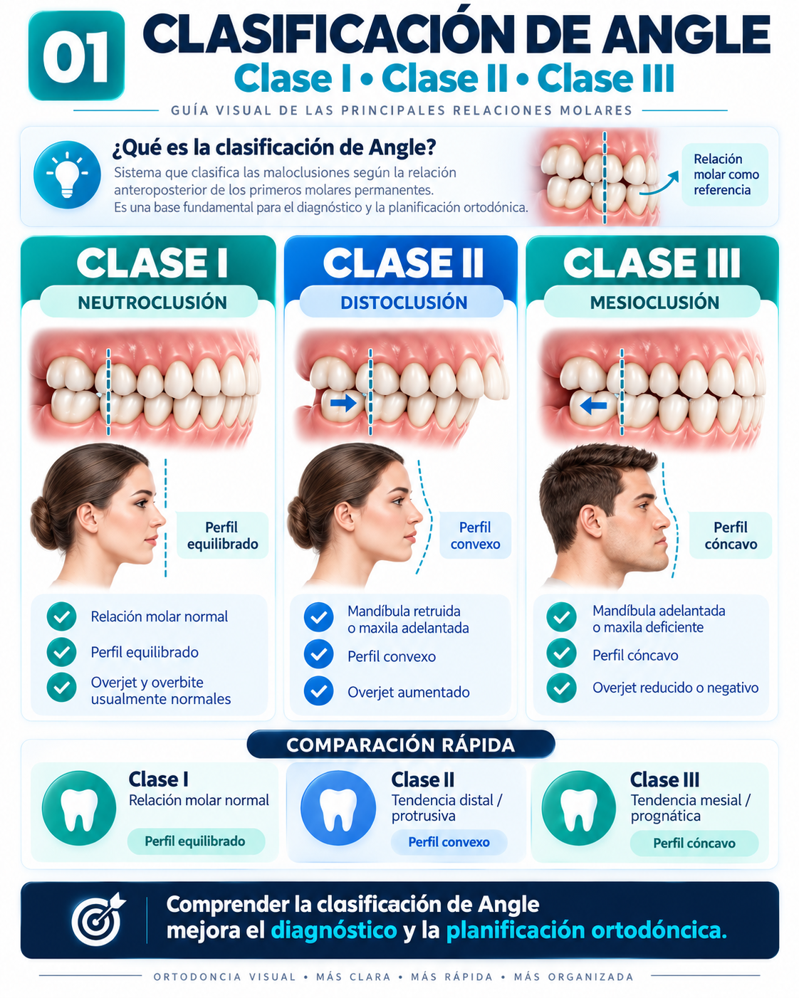Clasificación de Angle
