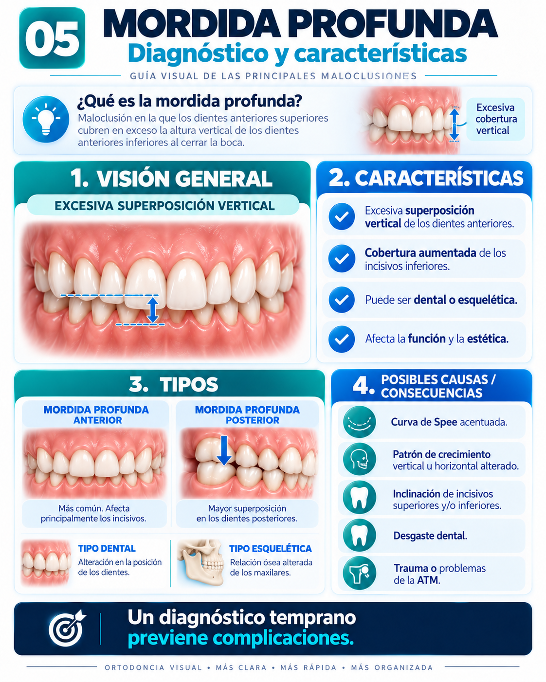 Mordida Profunda