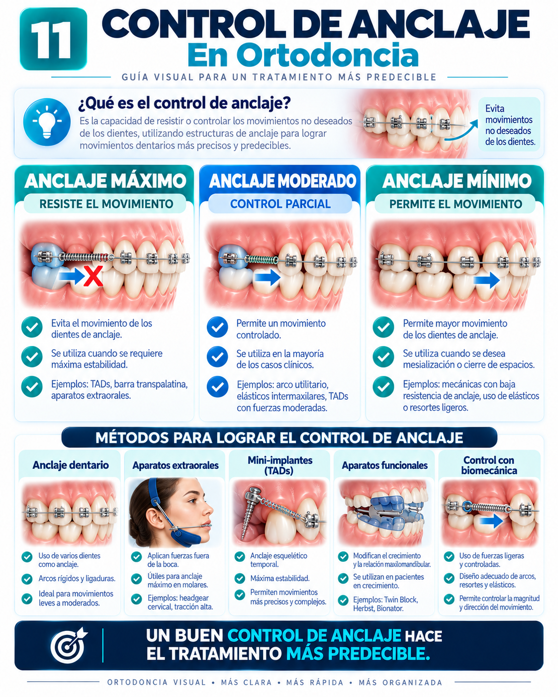 Control de Anclaje